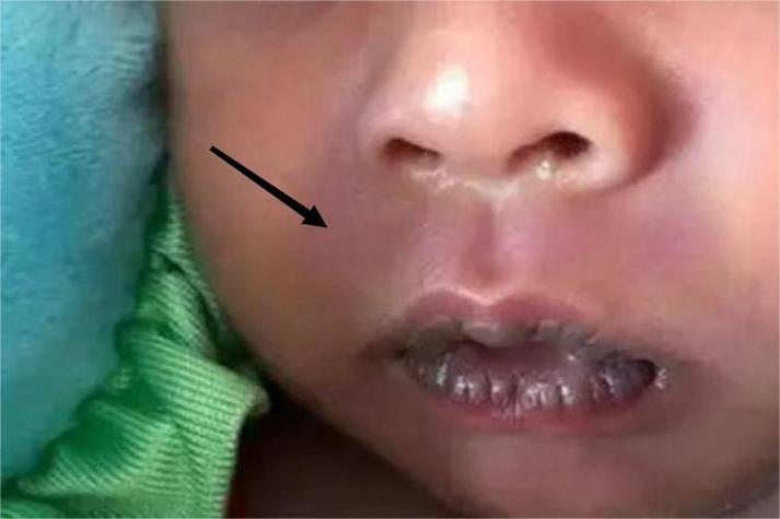 儿童心脏病症状有哪些？家长需警惕哪些异常表现？-第3张图片-郑州医学网