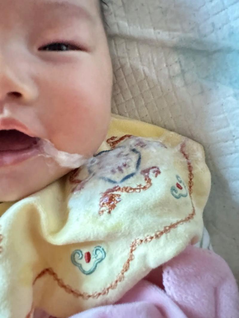 新生儿吐奶后哭闹不止，家长该如何正确安抚与应对？-第2张图片-郑州医学网