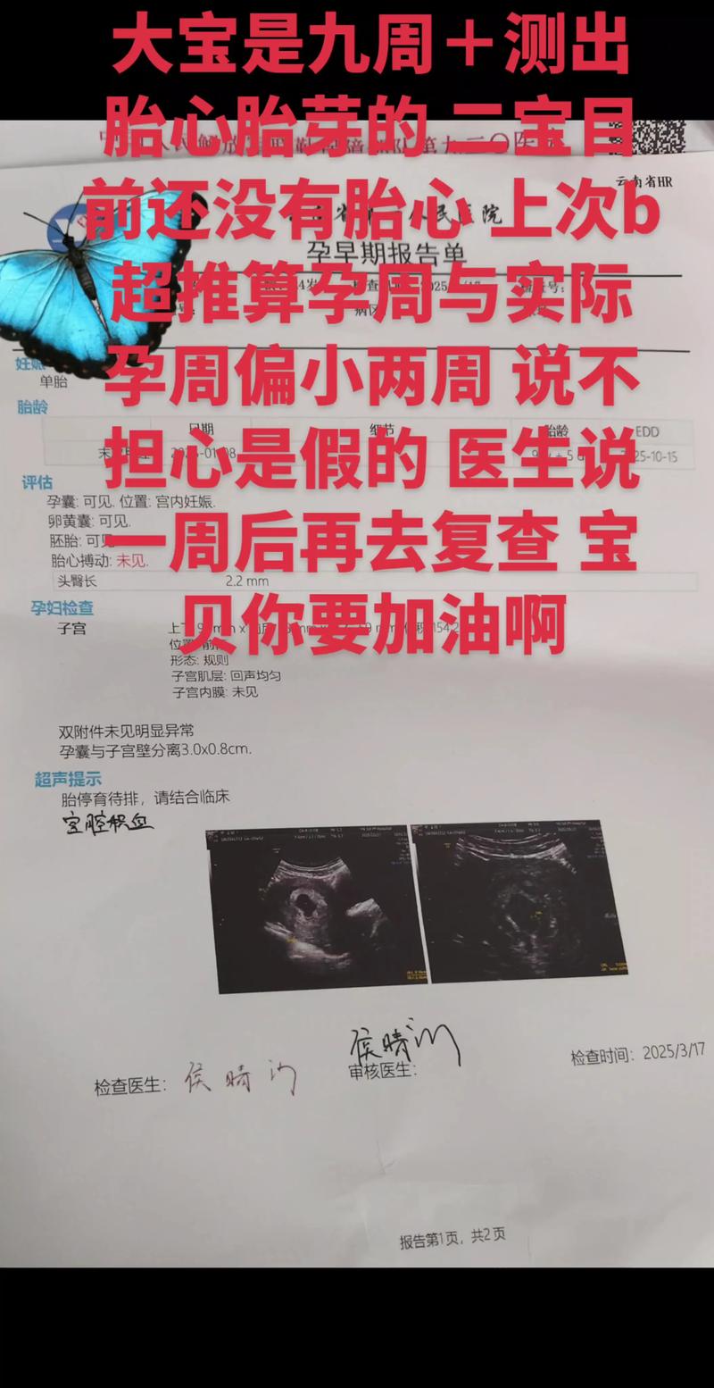 孕期多久能检测到胎心胎芽？早孕期B超检查时间有讲究吗？-第1张图片-郑州医学网