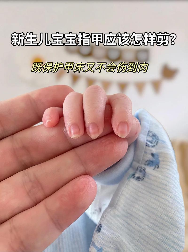 新生儿剪指甲到底能不能剪？新手爸妈该如何正确操作？-第2张图片-郑州医学网