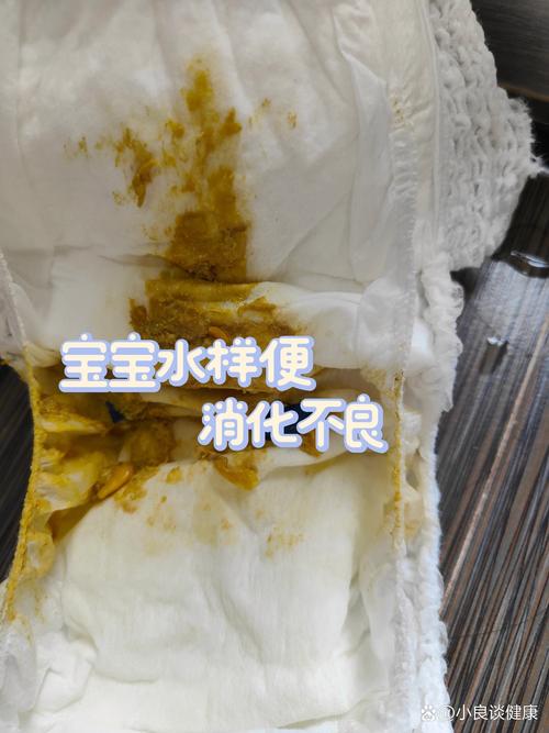 新生儿大便呈水样是腹泻吗？需要就医吗？家长该怎么护理？-第1张图片-郑州医学网