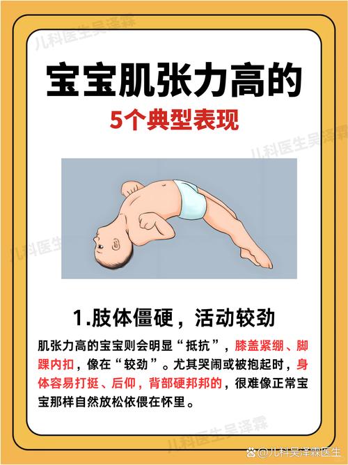 新生儿打挺是正常现象吗？具体表现和哪些原因有关？-第1张图片-郑州医学网