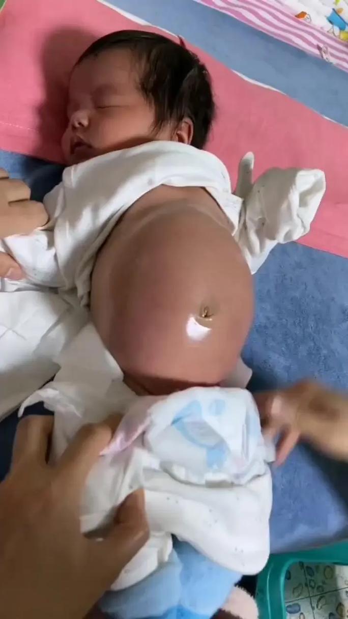 新生儿打挺是正常现象吗？具体表现和哪些原因有关？-第2张图片-郑州医学网