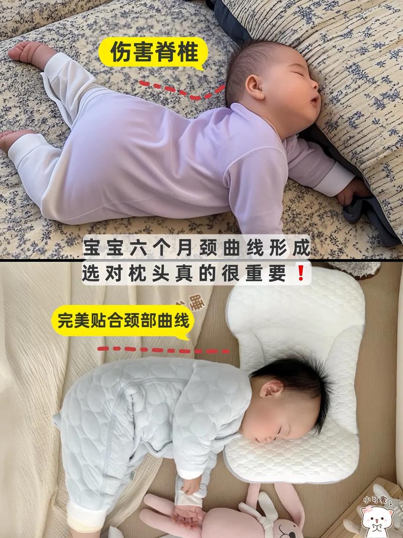 新生儿打挺是正常现象吗？具体表现和哪些原因有关？-第3张图片-郑州医学网