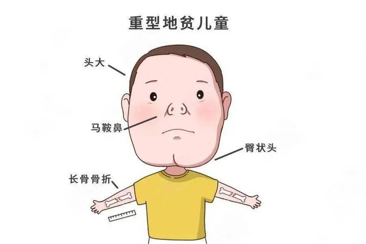 地贫儿童外貌特征有哪些具体表现？图片展示能帮助早期识别吗？-第2张图片-郑州医学网