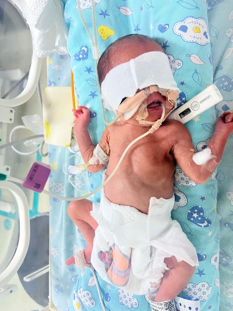 孕期28周宝宝有多大?胎儿发育标准与实际大小差异大吗?-第3张图片-郑州医学网 孕期28周宝宝有多大?胎儿发育标准与实际大小差异大吗?-第3张图片-郑州医学网