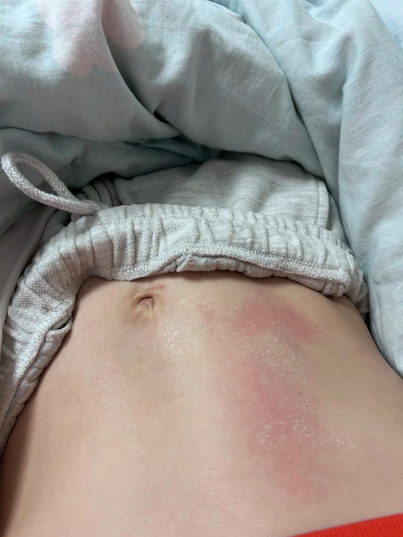 孕期晚上睡觉身上发烫是正常现象吗?需要担心哪些健康问题?-第1张图片-郑州医学网 孕期晚上睡觉身上发烫是正常现象吗?需要担心哪些健康问题?-第1张图片-郑州医学网