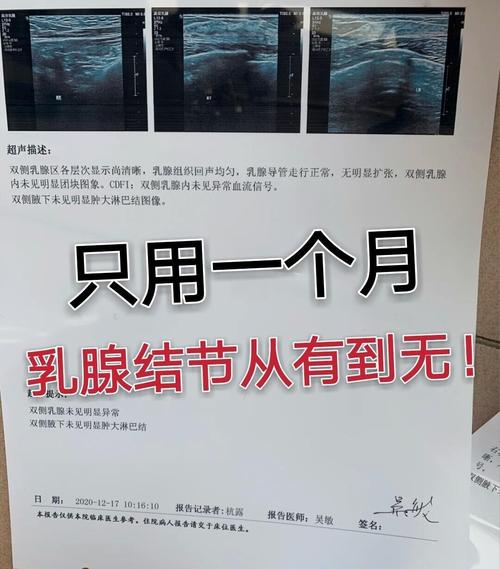孕期乳腺结节快速增长-第3张图片-郑州医学网 孕期乳腺结节快速增长-第3张图片-郑州医学网