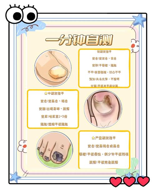 孕期剪指甲真的有禁忌吗？科学解读背后的健康风险与注意事项-第3张图片-郑州医学网