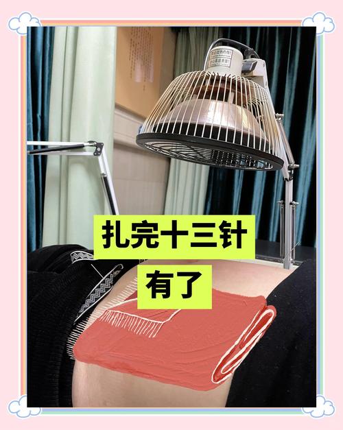 怀孕期间用针线真的安全吗？会对胎儿有潜在影响吗？-第3张图片-郑州医学网