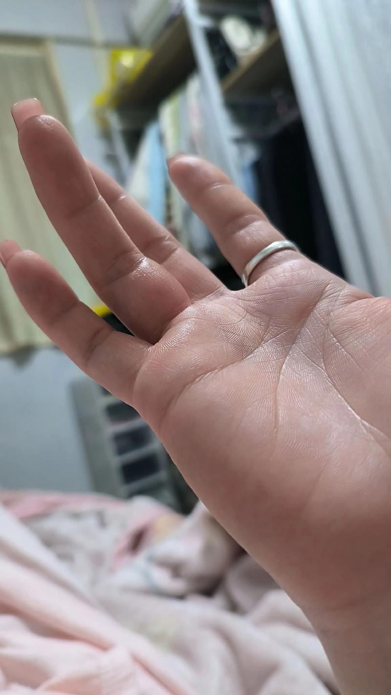 怀孕期间手肿是正常现象吗？需要警惕哪些潜在问题？-第2张图片-郑州医学网