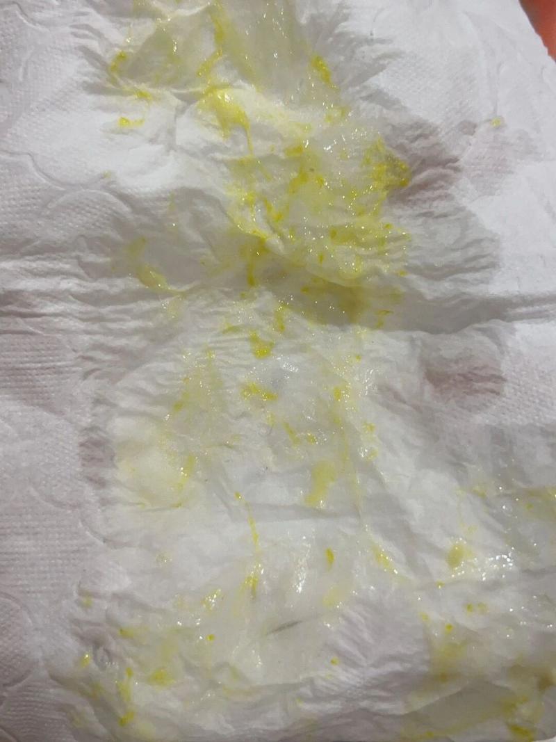 新生儿咳嗽吐奶带黏液是正常现象还是疾病信号？-第1张图片-郑州医学网