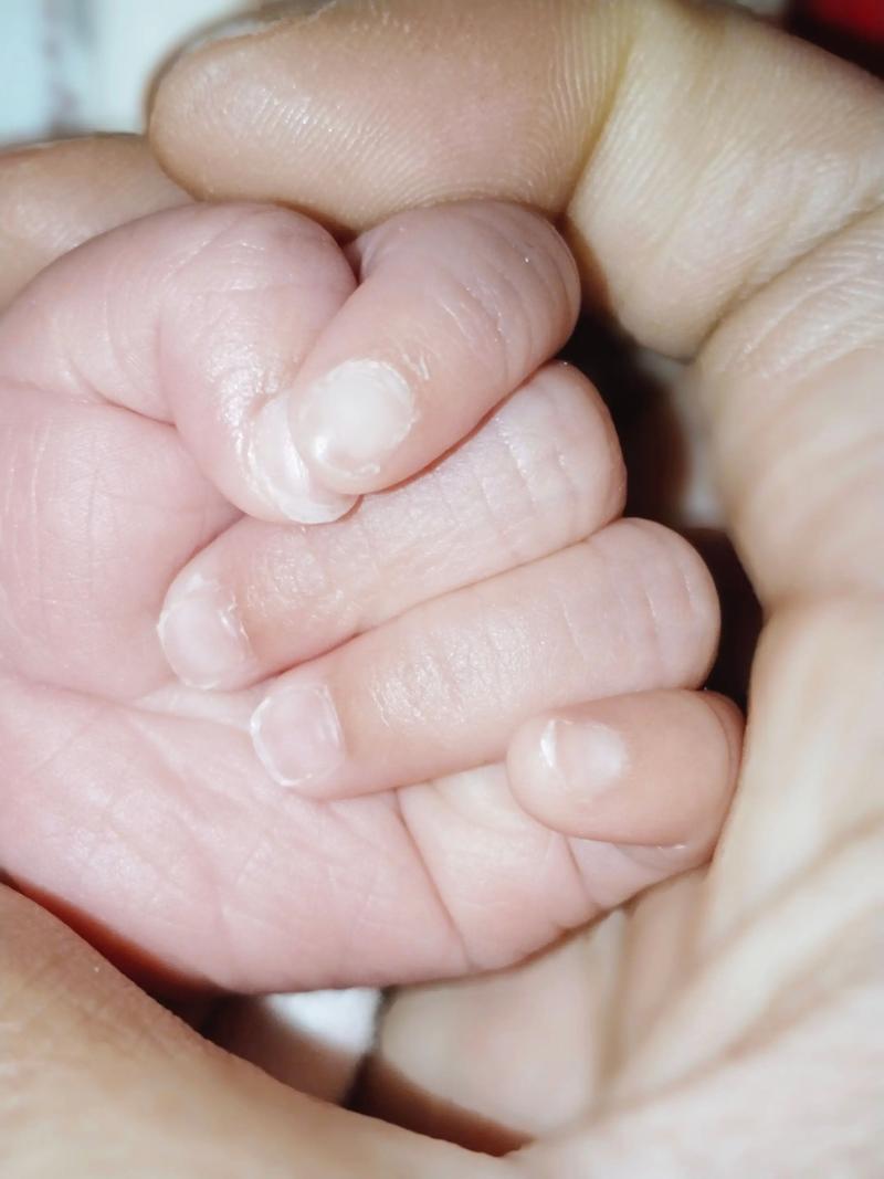 为什么新生儿唯独手部肤色白皙，身体其他部位颜色较深？-第3张图片-郑州医学网