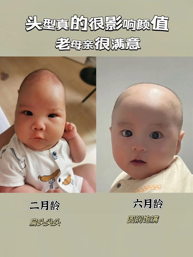 新生儿睡觉总偏头是习惯问题还是发育异常？需要干预吗？-第2张图片-郑州医学网