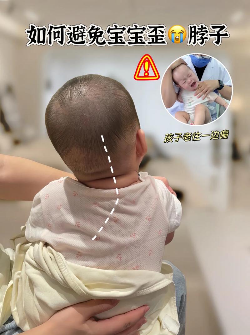 新生儿睡觉总偏头是习惯问题还是发育异常？需要干预吗？-第3张图片-郑州医学网