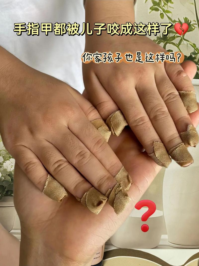 新生儿啃手指是饿了还是习惯？家长该如何科学应对？-第2张图片-郑州医学网