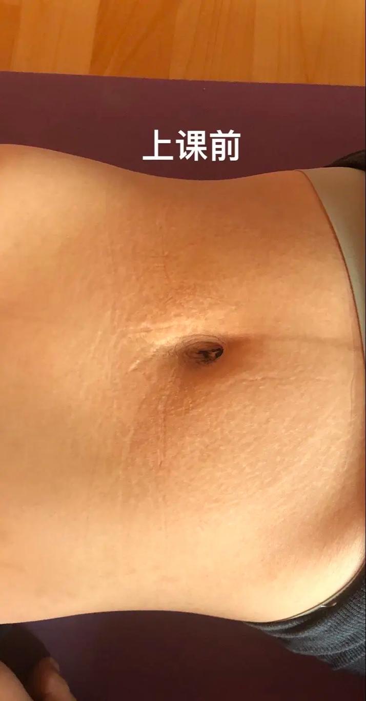 怀孕期间肚脐眼突然凹进去，是正常现象还是胎儿有异常信号？-第3张图片-郑州医学网