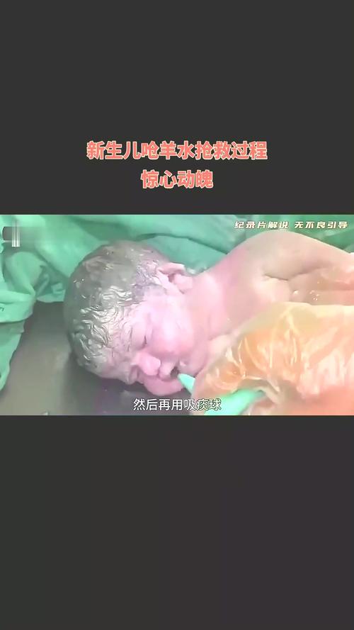 新生儿呛羊水后呼吸困难，家长如何紧急处理与后续观察？-第1张图片-郑州医学网