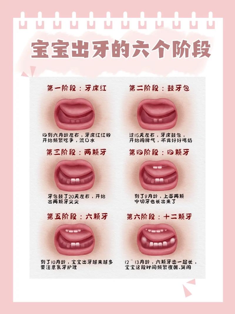 新生儿鬼牙的迷信说法究竟从何而来？它背后隐藏着怎样的文化密码？-第1张图片-郑州医学网