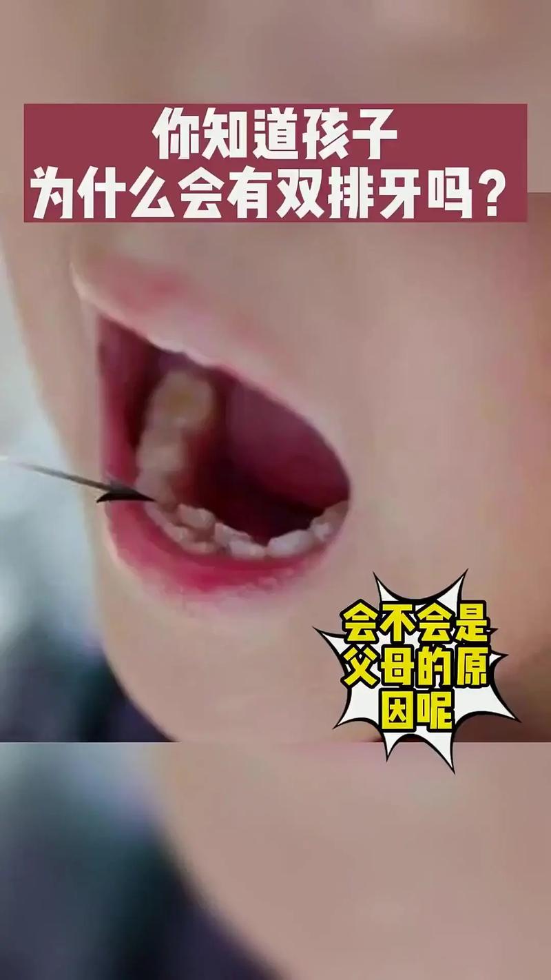 新生儿鬼牙的迷信说法究竟从何而来？它背后隐藏着怎样的文化密码？-第3张图片-郑州医学网