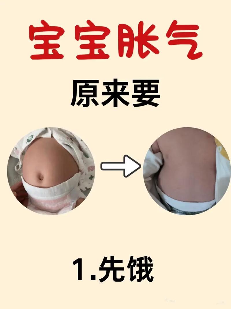 新生儿肠胀气到底该如何有效缓解与科学护理？-第3张图片-郑州医学网