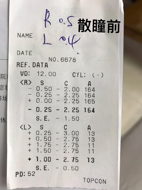 儿童散瞳后多久配眼镜最合适？散瞳后视力波动会影响配镜效果吗？-第1张图片-郑州医学网