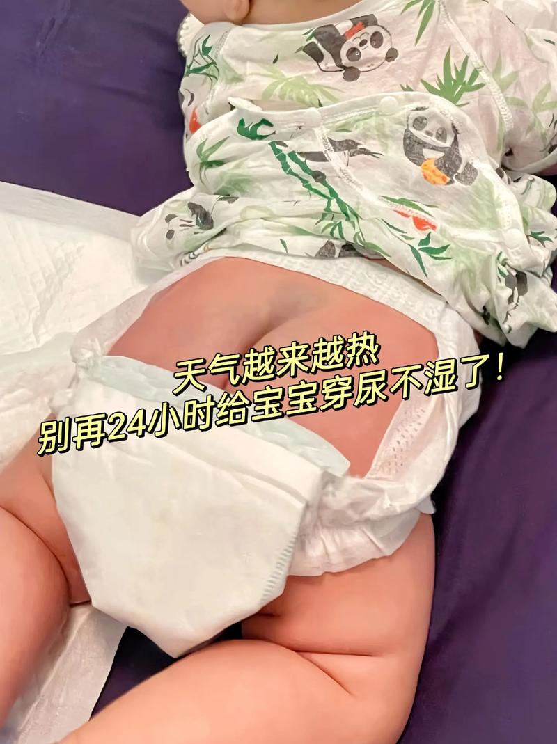 新生儿长期用尿不湿会影响发育吗？家长该如何科学选择与使用？-第3张图片-郑州医学网