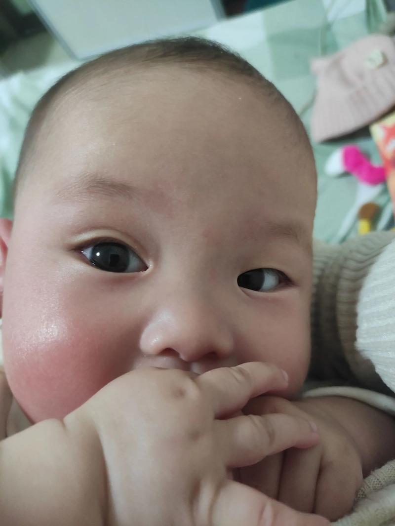 新生儿眼睛总上下左右瞟是正常现象还是发育异常？-第1张图片-郑州医学网