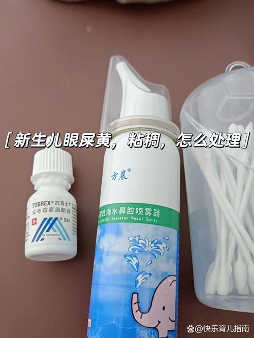 新生儿黄眼屎眼睁不开是结膜炎还是鼻泪管堵塞？-第1张图片-郑州医学网