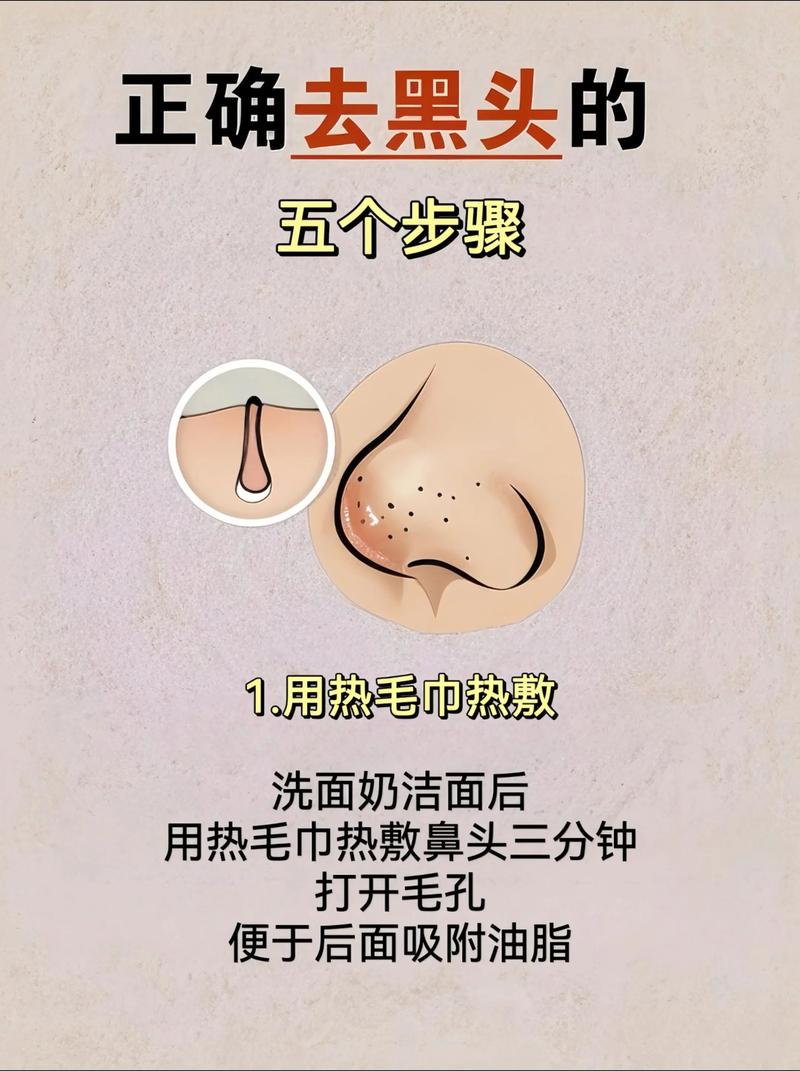 儿童鼻子黑头频现，日常清洁能根除吗？需警惕哪些护肤误区？-第2张图片-郑州医学网