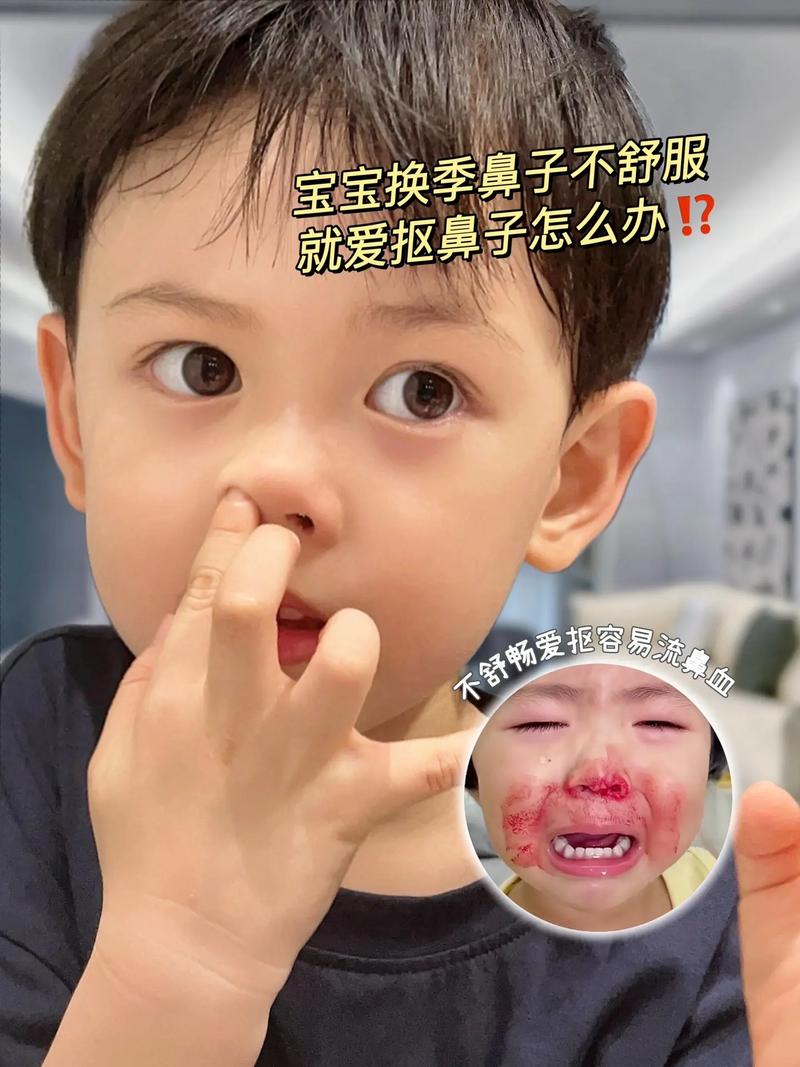 儿童鼻子黑头频现，日常清洁能根除吗？需警惕哪些护肤误区？-第3张图片-郑州医学网