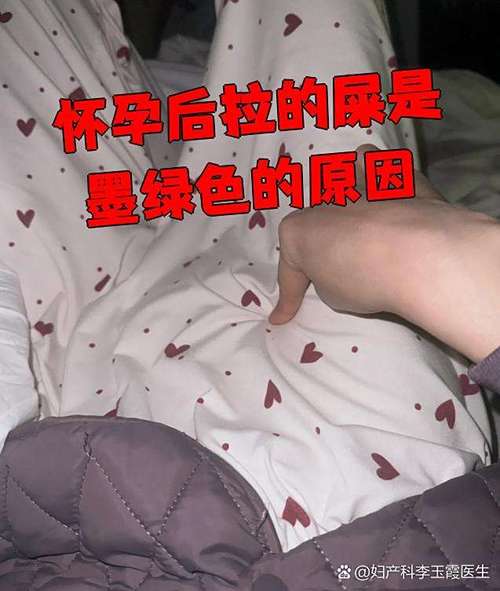 怀孕期间大便黑绿是正常现象还是身体发出的异常信号？-第1张图片-郑州医学网