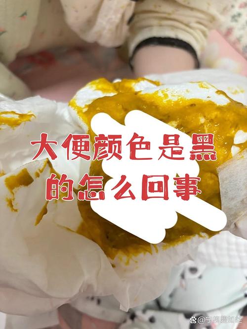 怀孕期间大便黑绿是正常现象还是身体发出的异常信号？-第3张图片-郑州医学网