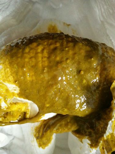 怀孕期间大便黑绿是正常现象还是身体发出的异常信号？-第2张图片-郑州医学网