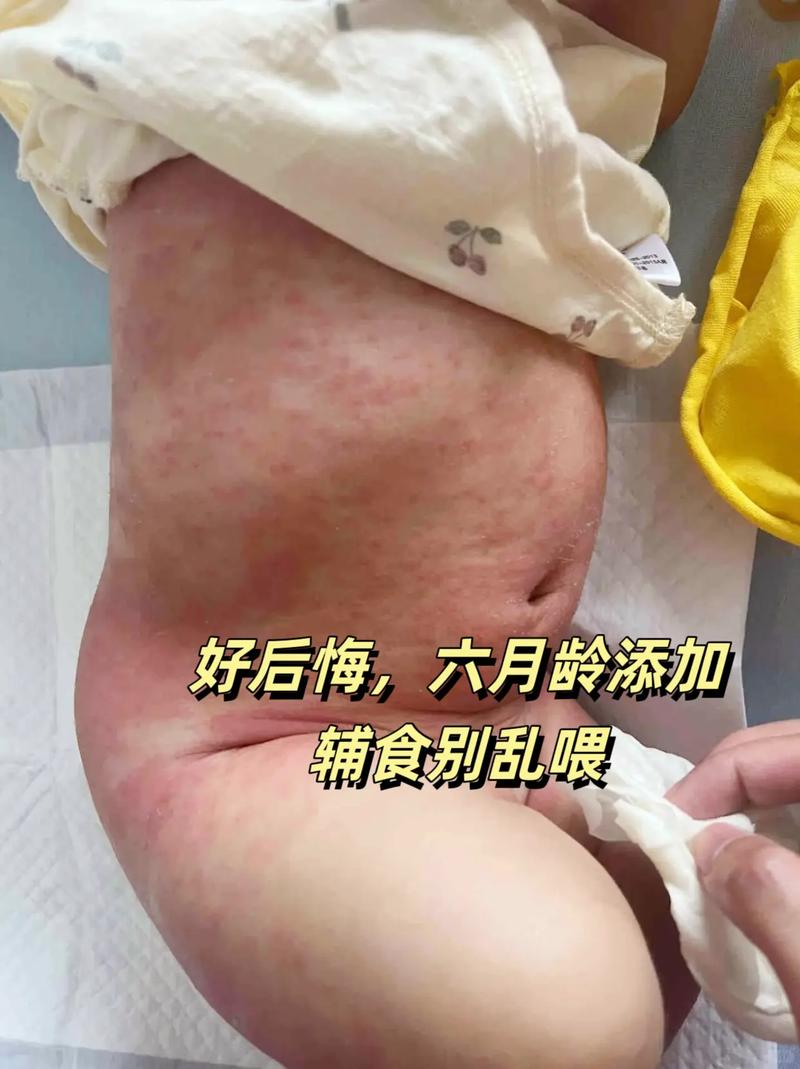 新生儿五六个小时不吃奶是正常现象还是异常信号？需警惕哪些潜在问题？-第3张图片-郑州医学网