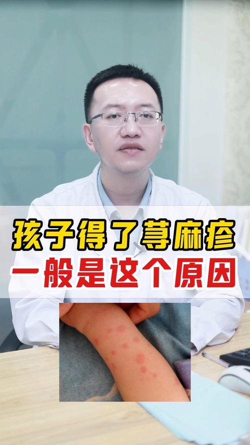 儿童麻疹初期症状易与感冒混淆，如何准确识别并科学治疗？-第2张图片-郑州医学网