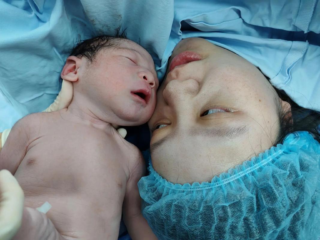 新生儿4天拍胸透会影响生长发育吗？辐射风险究竟有多大？-第1张图片-郑州医学网