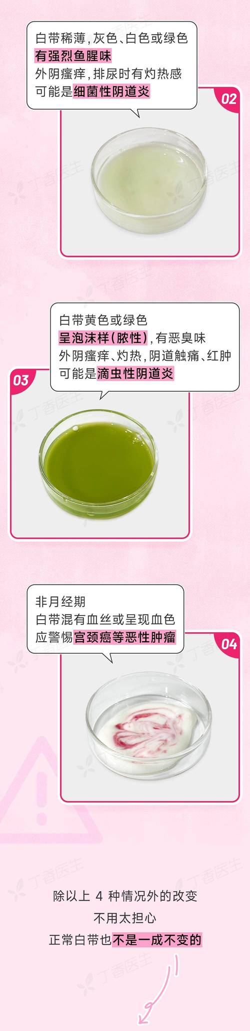 孕期出现黄绿色分泌物且伴有瘙痒，是何种异常信号？需警惕哪些妇科问题？-第1张图片-郑州医学网