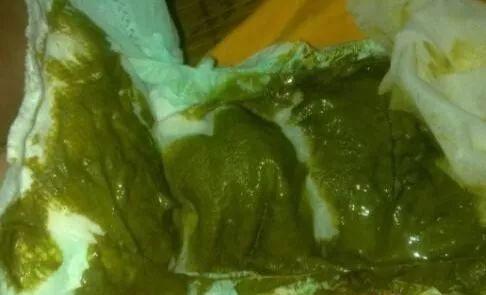 孕期排出墨绿色大便是否正常？会对胎儿健康有影响吗？-第3张图片-郑州医学网