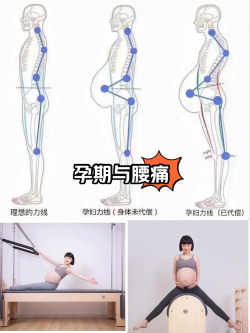 怀孕期间背疼怎么回事-第3张图片-郑州医学网