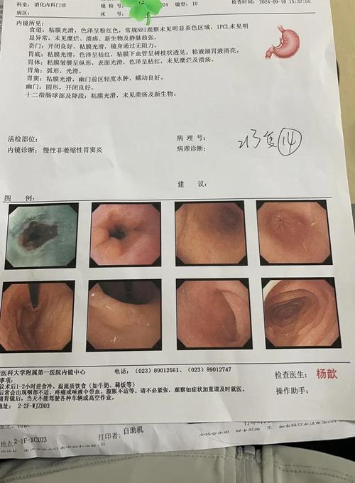 怀孕期间做了无痛肠镜，会对胎儿或孕妇造成哪些影响？-第1张图片-郑州医学网