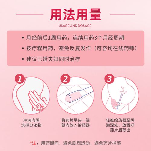 孕期用克霉唑栓会影响胎儿健康吗？医生如何权衡用药安全性与治疗效果？-第2张图片-郑州医学网