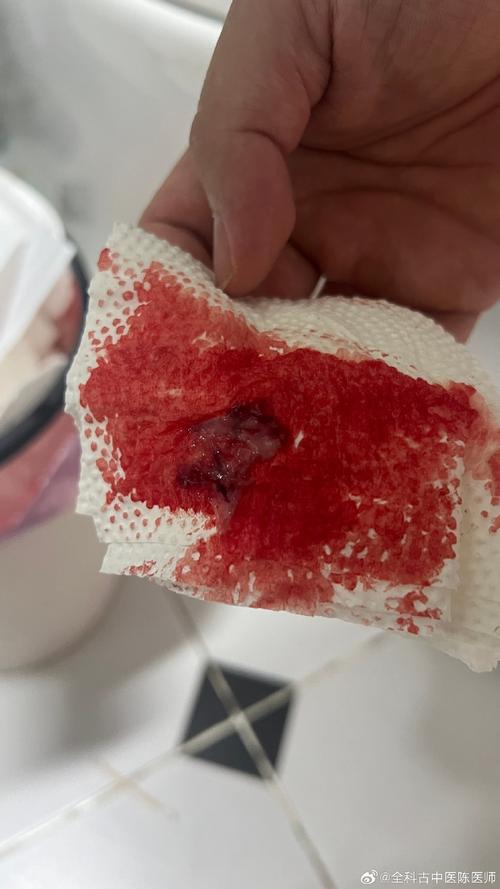 怀孕期间子宫内出现积血，会对胎儿发育造成哪些影响？-第1张图片-郑州医学网