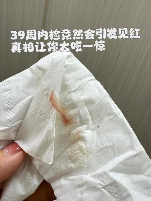 怀孕期间子宫内出现积血，会对胎儿发育造成哪些影响？-第3张图片-郑州医学网