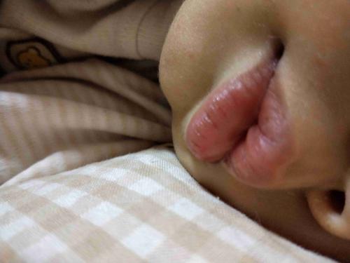 新生儿嘴唇颜色偏红紫是缺氧还是正常生理现象？需警惕哪些潜在问题？-第1张图片-郑州医学网