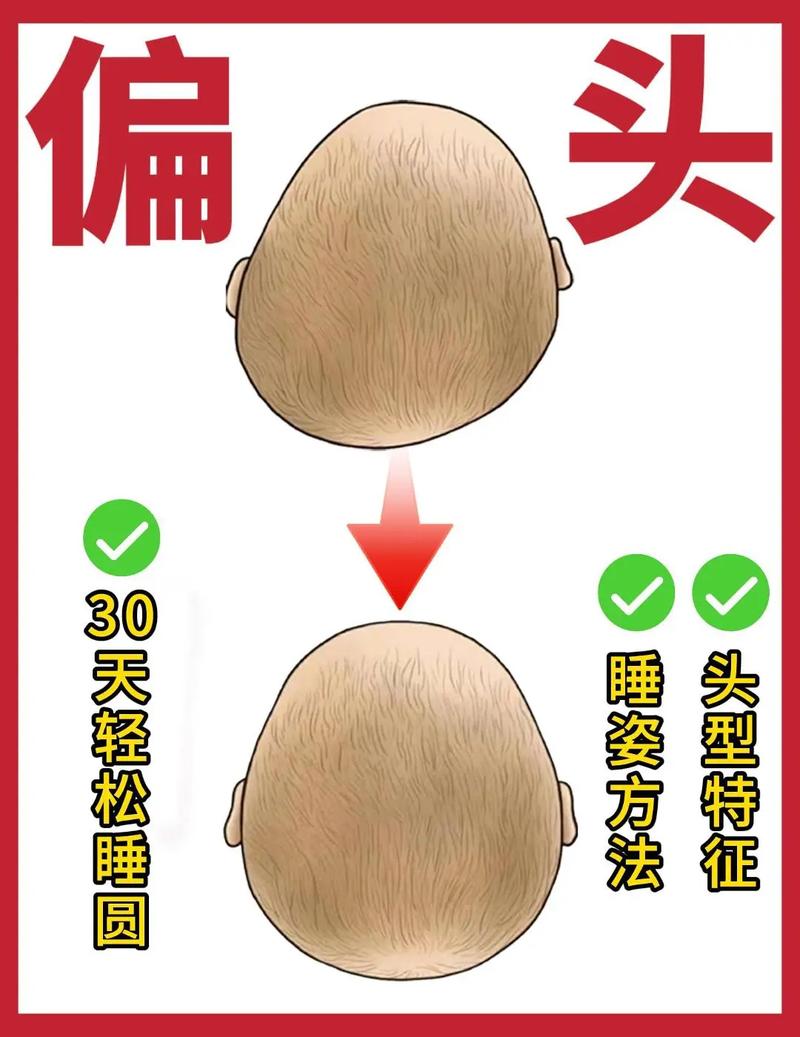 新手爸妈必看！如何科学预防新生儿头睡偏，守护宝宝头型健康？-第1张图片-郑州医学网