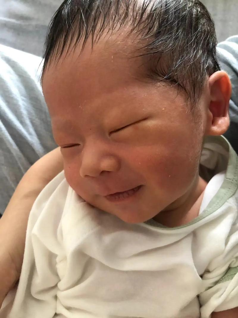 新生儿哪些异常表情需警惕？家长如何识别危险信号并应对？-第3张图片-郑州医学网