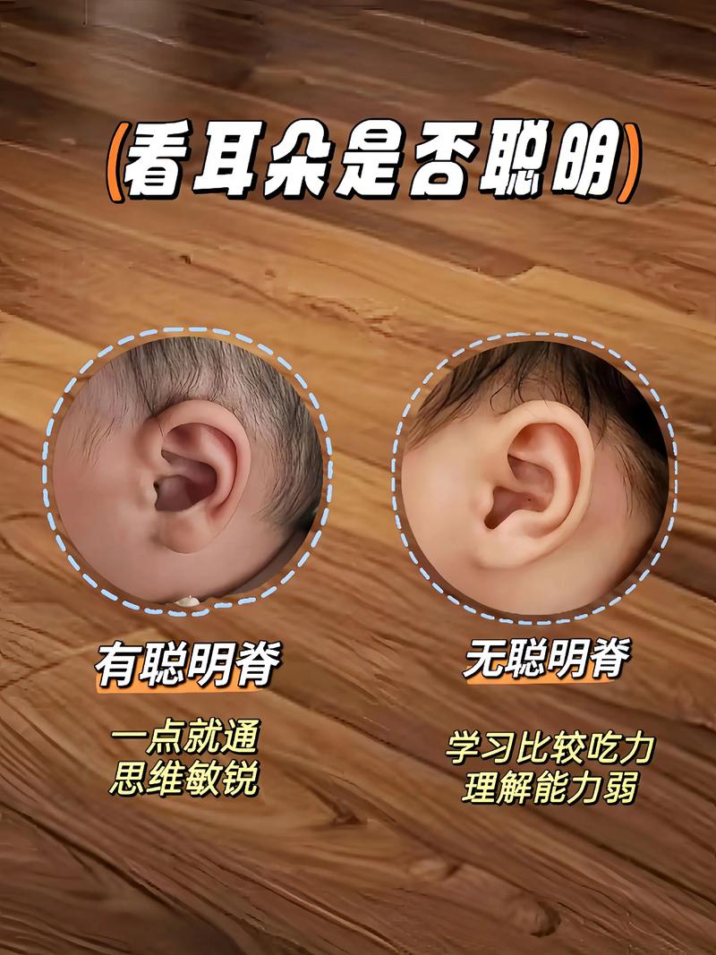新生儿垂耳能自行恢复吗？家长该如何科学判断与干预？-第3张图片-郑州医学网