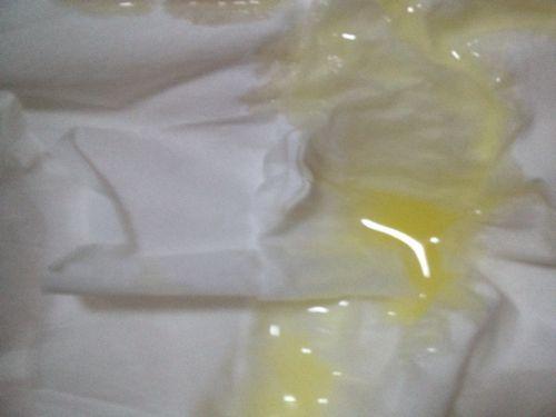 孕期出现黄绿色分泌物是感染了吗？对胎儿有影响吗？需要怎么处理？-第1张图片-郑州医学网