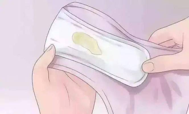 孕期出现黄绿色分泌物是感染了吗？对胎儿有影响吗？需要怎么处理？-第2张图片-郑州医学网